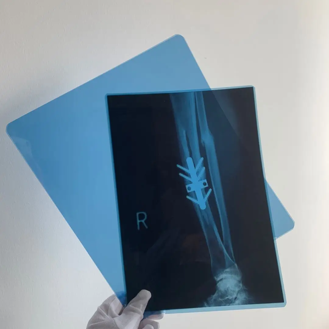 China OEM 210um Medical Blue Base X Ray Film in 8x10 14x17 Sheets