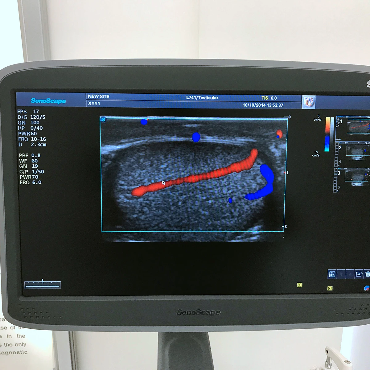 Медицинские ультразвуковые инструменты sonoscape s22 ультразвуковая машина