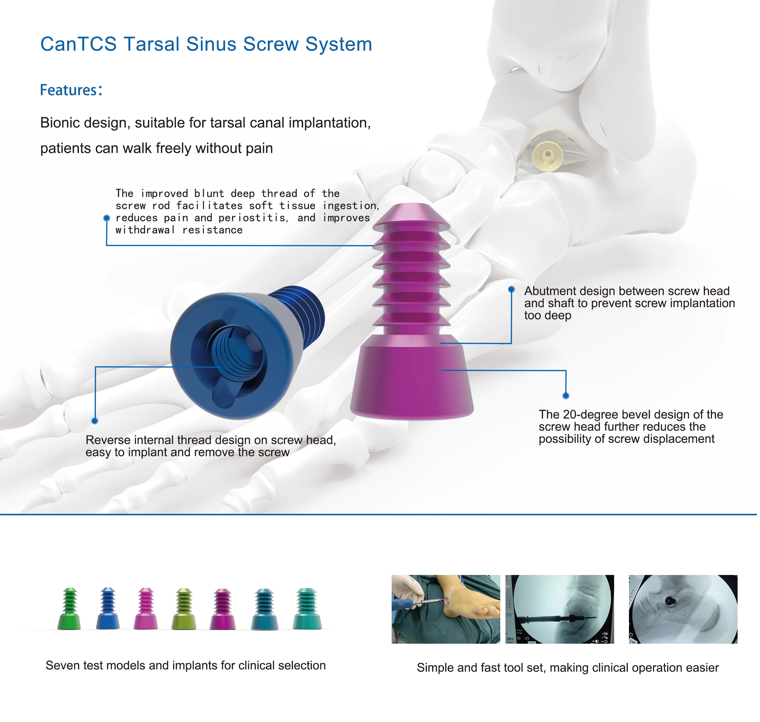 CANWELL  Foot and Ankle System Orthopedic Screw Titanium Talar Sinus Tarsal Screw