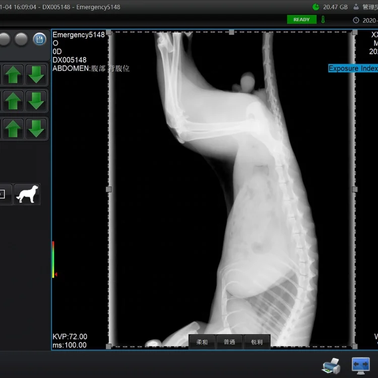 Панельный детектор flat iray 17*17 беспроводной плоский панельный mars 1717 качество с dr