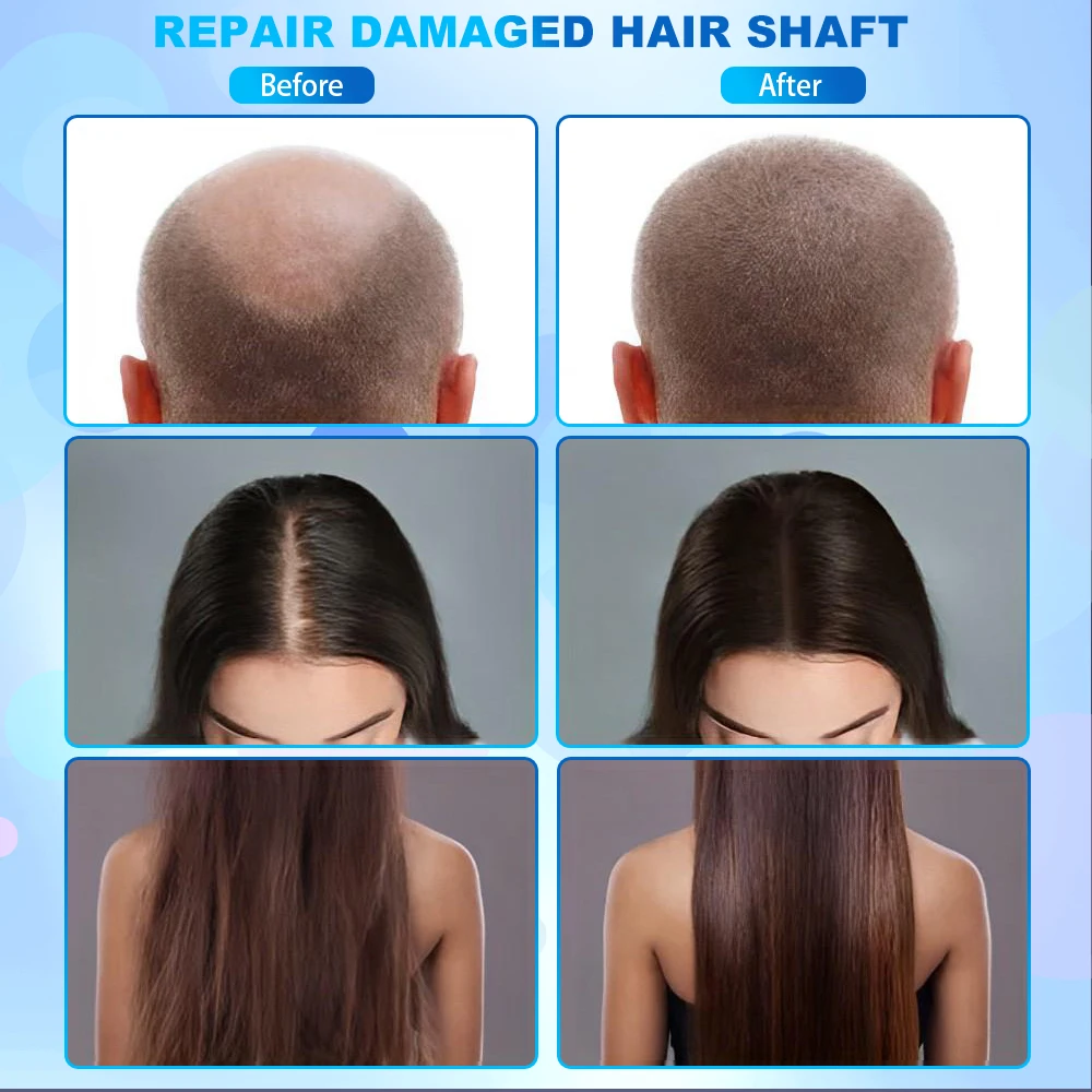 portable 7 in 1 scrub massager brush and scalp for hair growth skin analyzer and camera treatment beauty machine