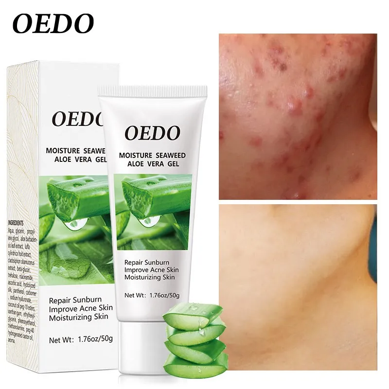 OEDO Desalination Remove Acne Marks Moisturizing Seaweed Aloe Vera
