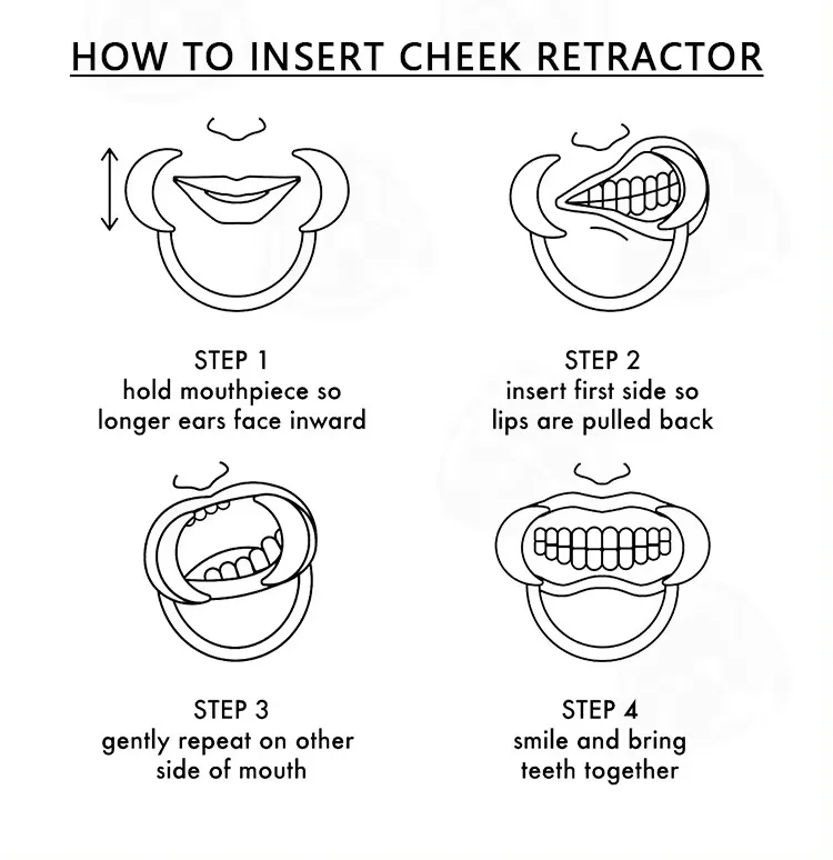 Wholesale C-Shape Medical Lip & Cheek Retractor Dental Mouth Opener