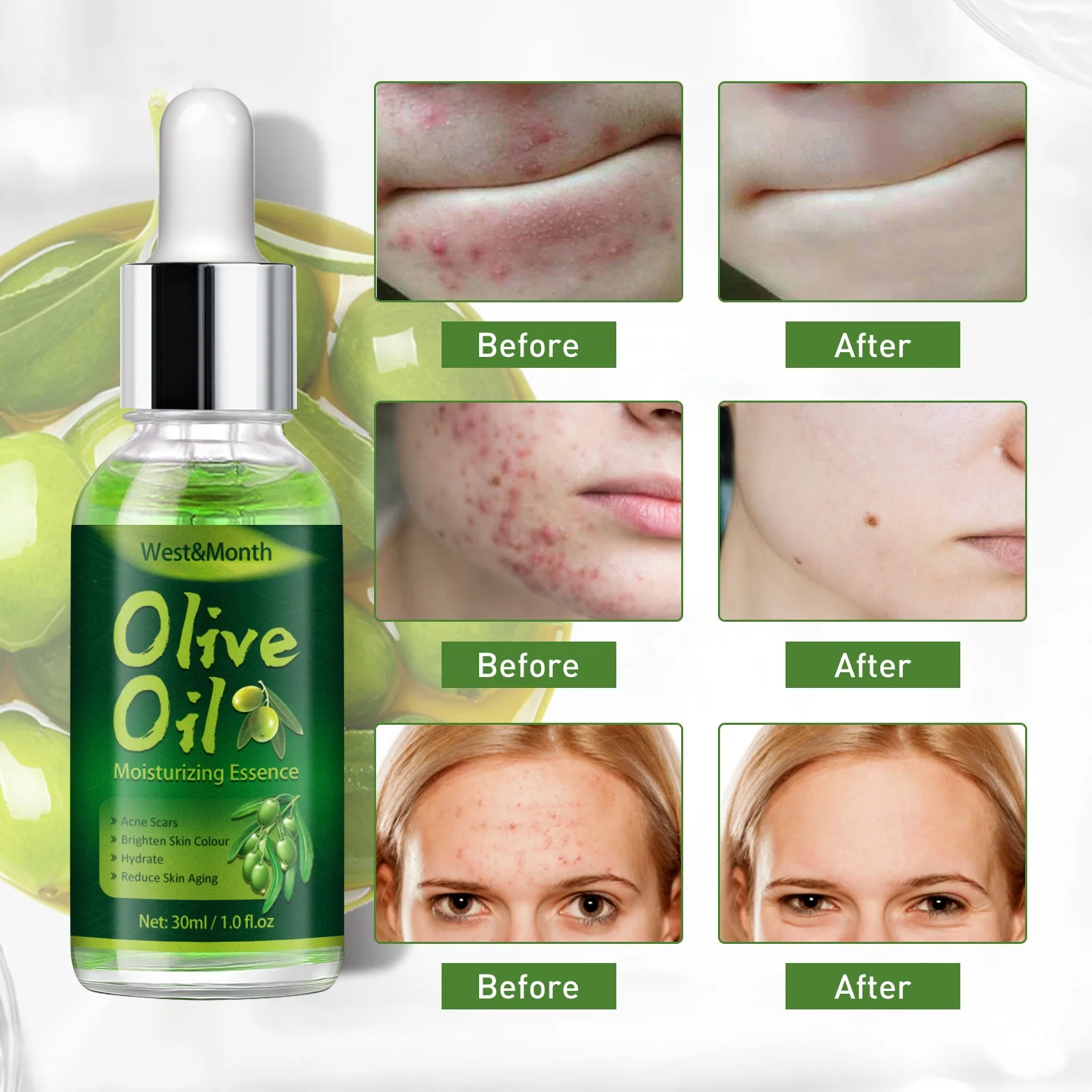 100% Natural Anti Aging Brightening Olive Oil Moisturizing Essence Serum Moisturizer For Acne Scars Remover, Skin Repair Healing