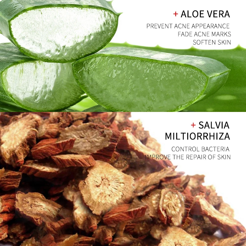 OEM/ODM Limpiador 30g Acne Removal Herbal Extract Skin Care Aloe Vera Acne Removal Gel for Acne Mark Skin