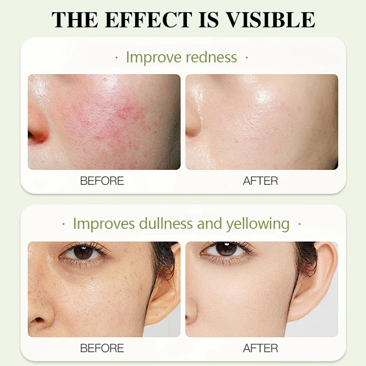 Dendrobium Face Emulsion Panthenol-Infused Facial Lotion for Stability Maintaining