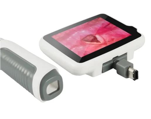 Portable Laringoscopio Pediatric Endoscope Digital USB Video Laryngoscope