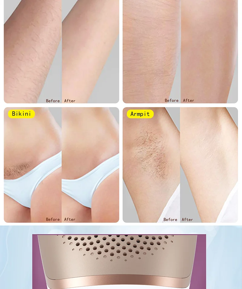 BEPERFECT Multifunctional Hand Held Portable Skin Rejuvenation Face Body Professional Laser Hair Removal Machine