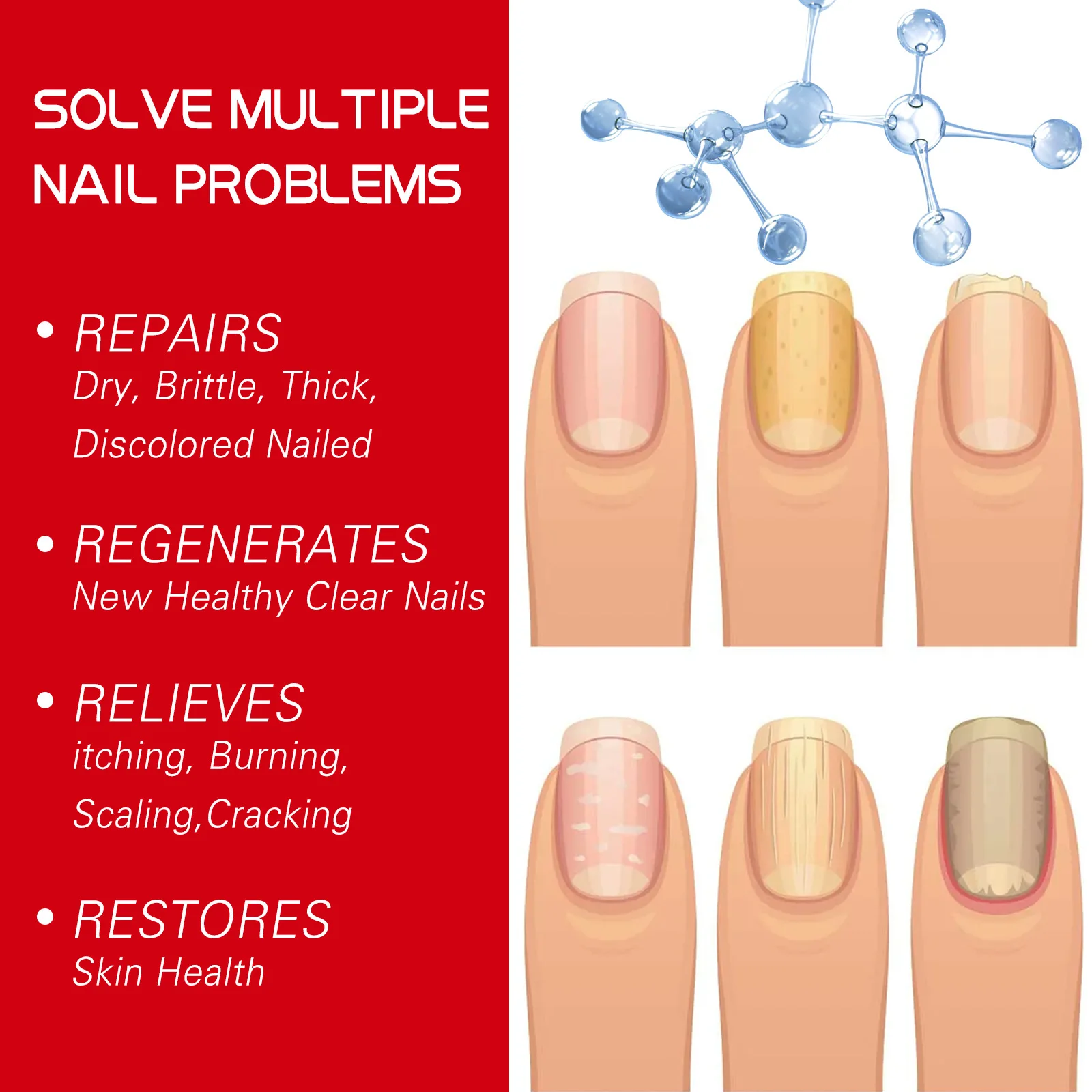 Feet Care Nail Foot Whitening Toe Nail Fungus Removal serum Gel Anti Infection Paronychia Onychomycosis Fungal Nail Treatment