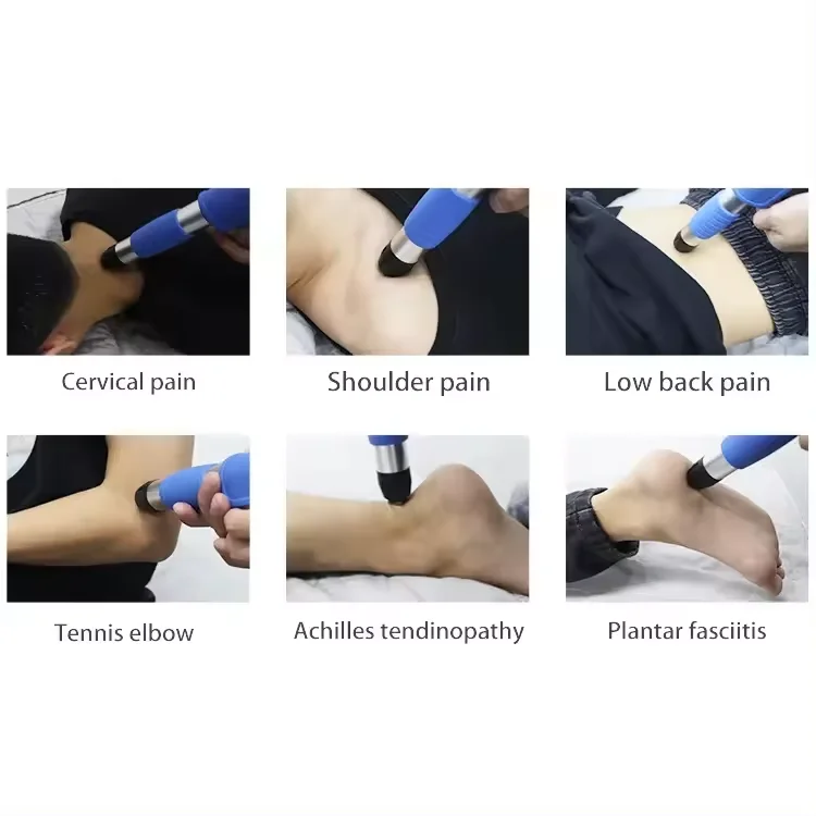 erectile dusfun penis pump shockwave machine for erectile dysfunction eswt shockwave best ozone therapy for pain realese