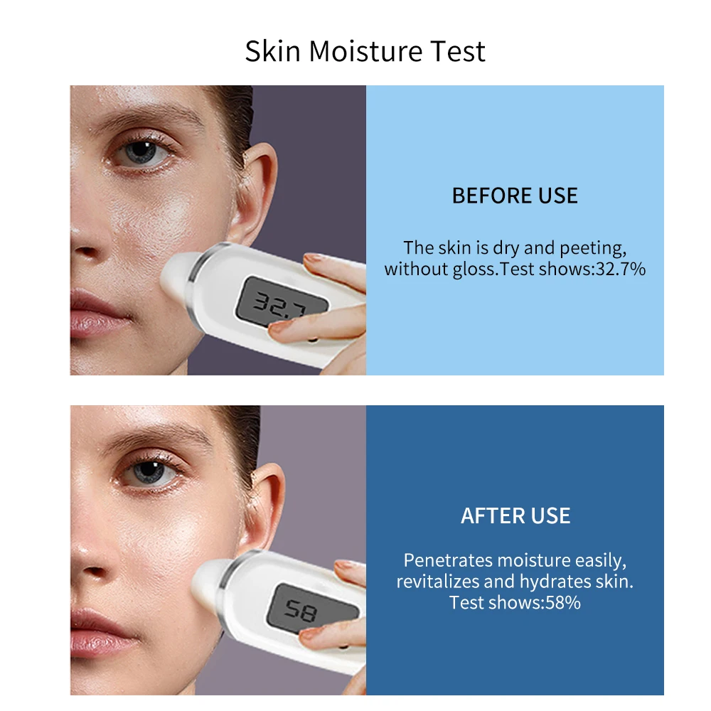 Advanced skin analy sis 15 in 1 function hydro dermabrasion machine/OEM/Customize logo