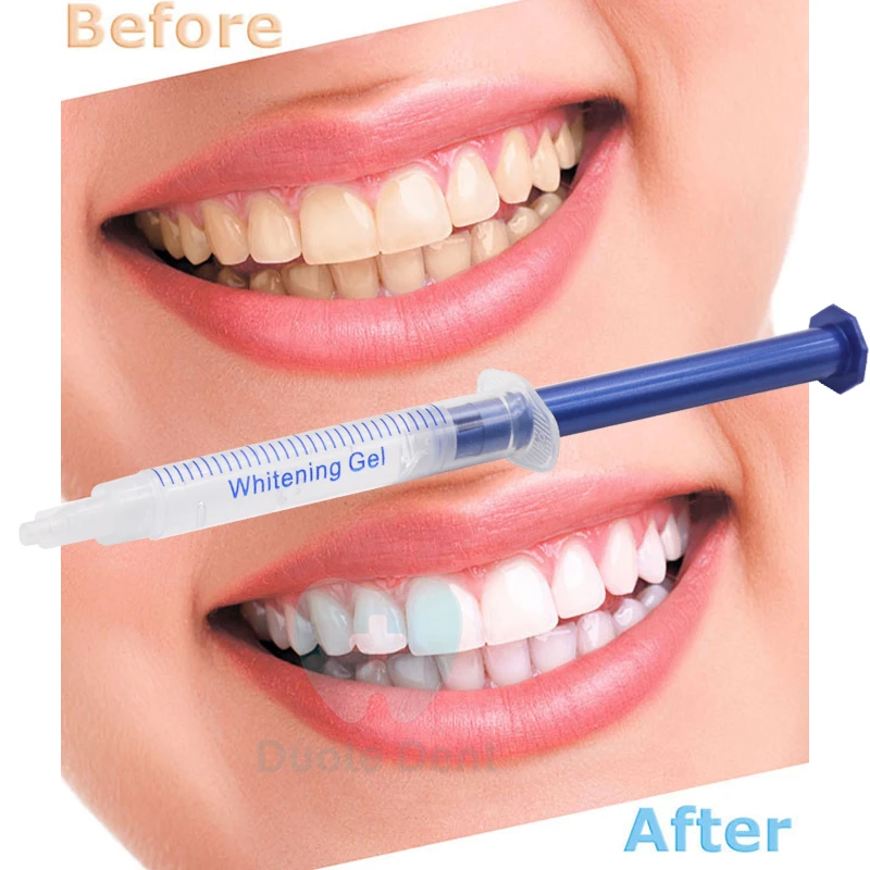 New Developed Dental 35%HP Teeth Whitening Gel Whitener Syringes Dental Teeth Whitener Gel