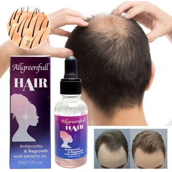 Free Sample Hair Scalp Treatment Promote Hair Growth oil Anti Hair Loss Anti Itching Oil