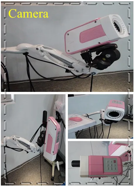 beautiful vagina colposcope/SW-3303 Digital Electronic Colposcope (Trolley-type)