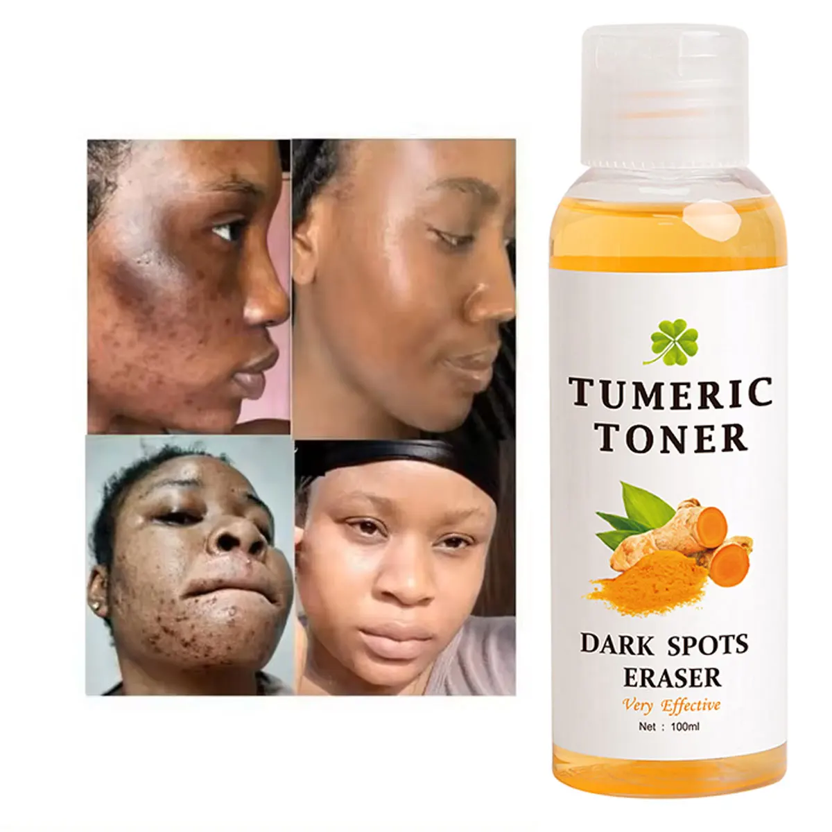 OEM Private Label Organic Vitamin C Dark Spot Eraser Turmeric Toner Strong Lightening Acne Remover Skincare Tumeric Face Toner