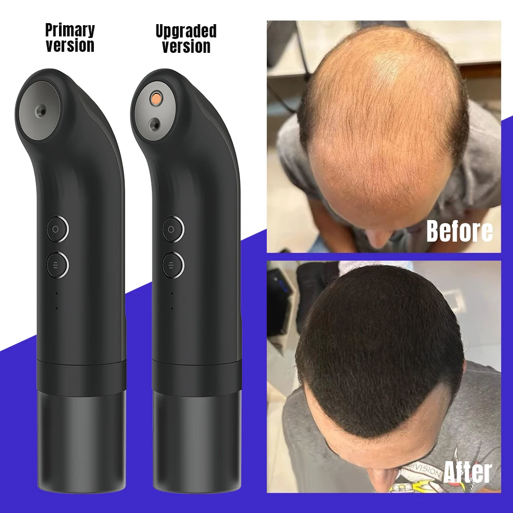 Hot Sale Topik Instant Keratin Hair Building Fibers hair Thickening Powder Fibres 27.5g Electric Hair Fiber Spray Applicator