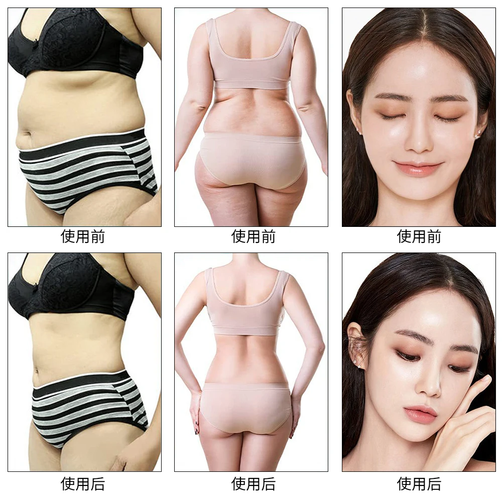 M 9 In 1 Vacuum 40k Cavitation Rf Lipo Laser Kim 8 Especial Slimming System Rf Lipo Cavitation Machine