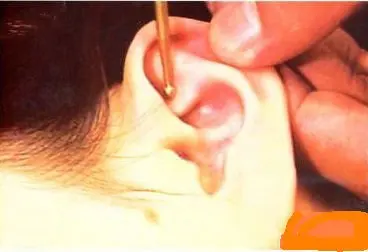 Health care ear acupuncture skin roller with facial and ear Acupoint massage machine beauty face roller with ear needle