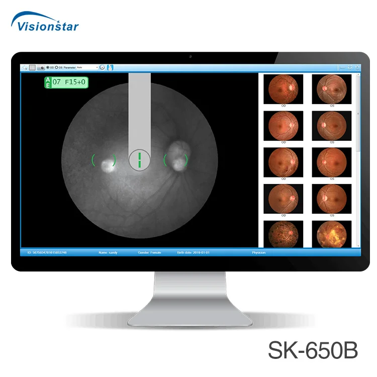 Popular Model SK-650B Non-mydriatic Fundus Camera