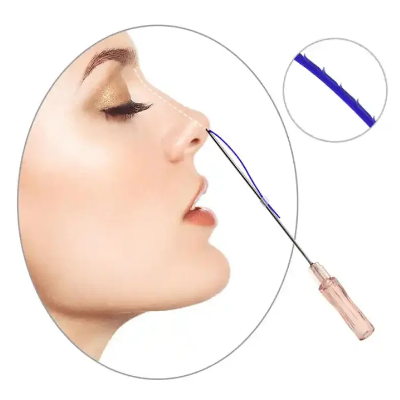 Speedy Recovery And Instant Effective Absorbable PDO Facelift Threads MONO COG Threads