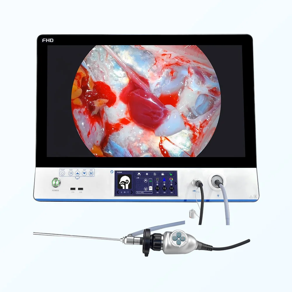SNUKE Portable Endoscopy Camera Medical Imaging Equipment HD Endoscope Camera for ENT/Laparoscopy/Hysteroscopy