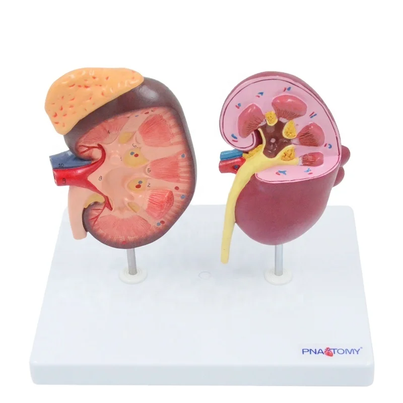 Normal and Diseased Kidney Model Urinary System Anatomy Model