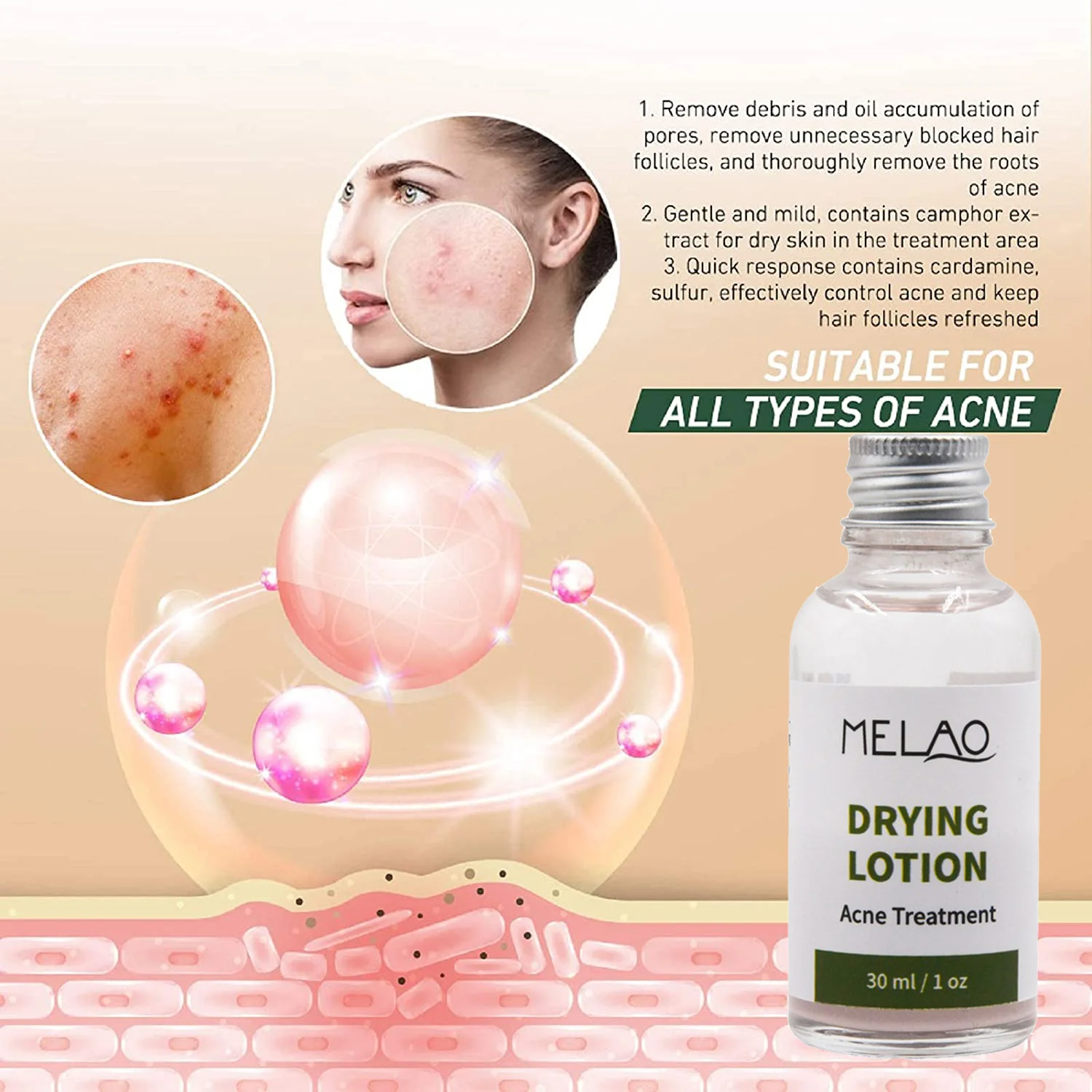 OEM/ODM High Quality Private Label Facial Care Natural Organic Acne Treatment MELAO Oil Balance Drying Lotion Acne Treatment