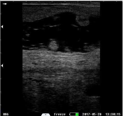 S1 vet ultrasound 14.JPG