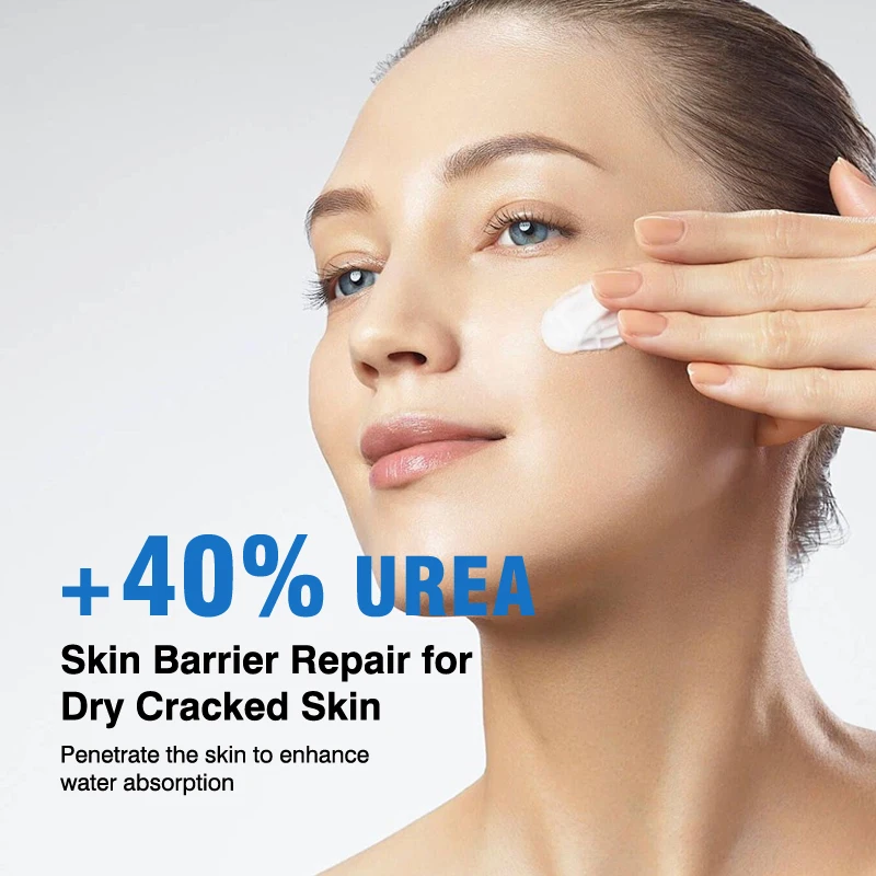 Wholesale Urea 40% Salicylic Acid Hands And Feet Cream Vitamin E Repair Moisturizing Crack Dry Skin Foot Care Products