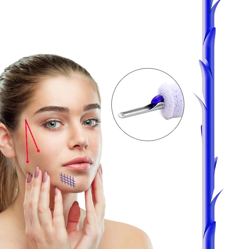 High quality korea hilos tensores para el rostro w canula cog 19g 100mm barbs lifting pdo thread for face lift