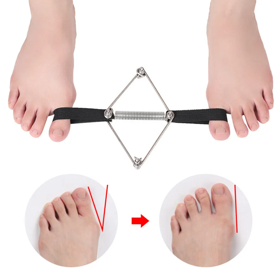 Big toe Separator Training belt Hallux valgus Corrector tension Strap Stainless Steel Springs foot Bunion stretch toe orthotics