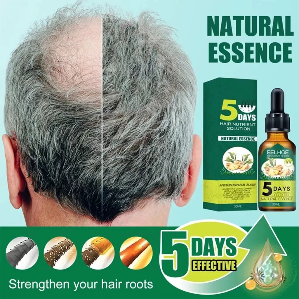 5 Days Ginger Hair Growth Products Natural Anti Hair Loss Prevent Baldness Treatment Fast Growing Nourish Dry Damaged Hair Care