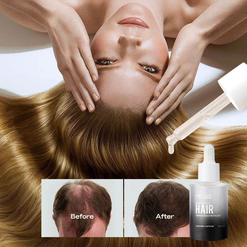 Custom Logohair Loss Treatment Scalp Serum Regrowth Anti Hair Fall Ginger Oil For Hair Growth Men