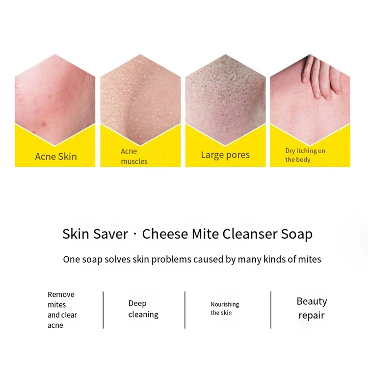 Wholesale Facial Cleanser Moisturizing Whitening Anti Acne Face Cleansing Glycerin Base Cheese Handmade Toilet Soap Bar