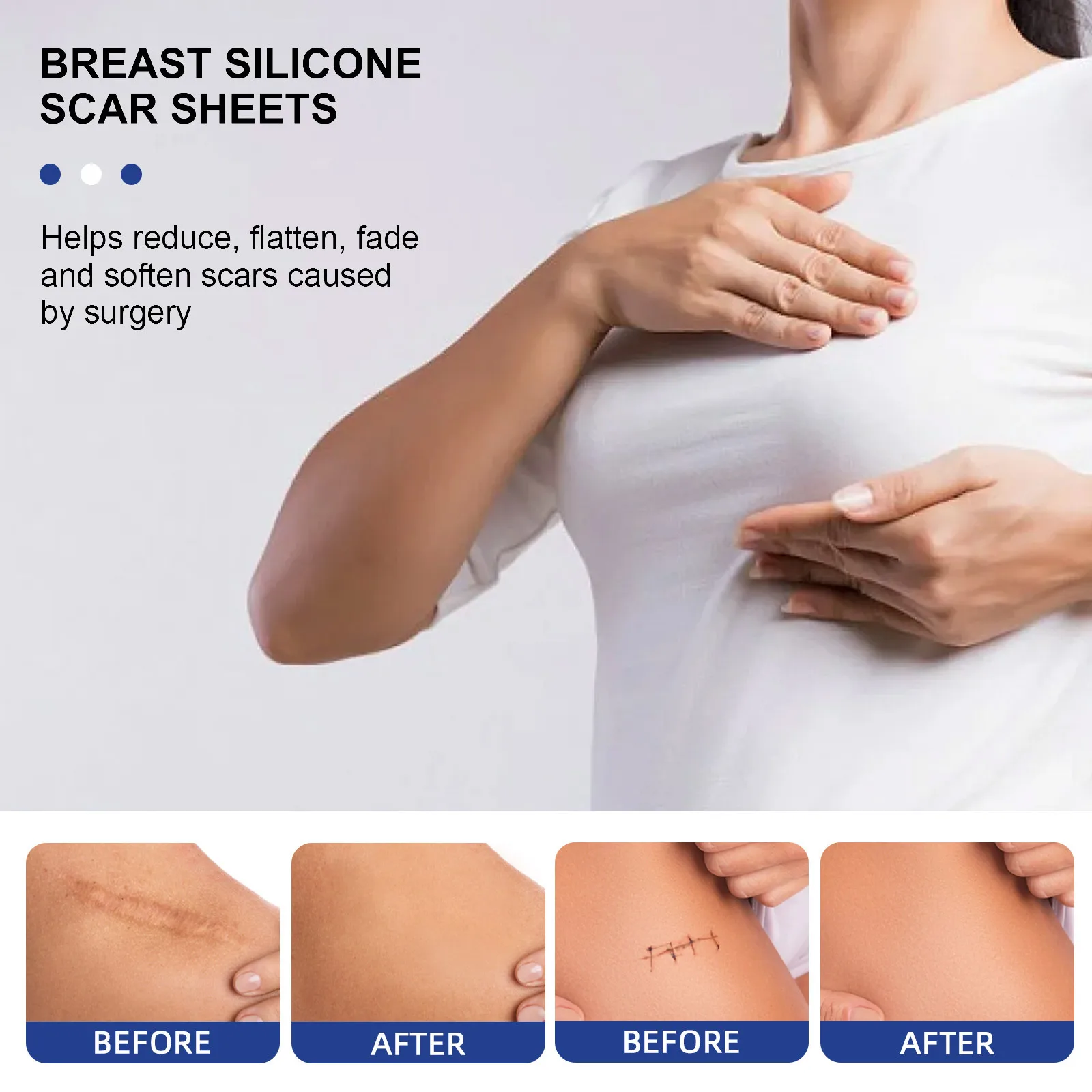 Breast Scar Sheet Areola Flattening Lightening and Softening for Breast Surgery Breast Scar Patch