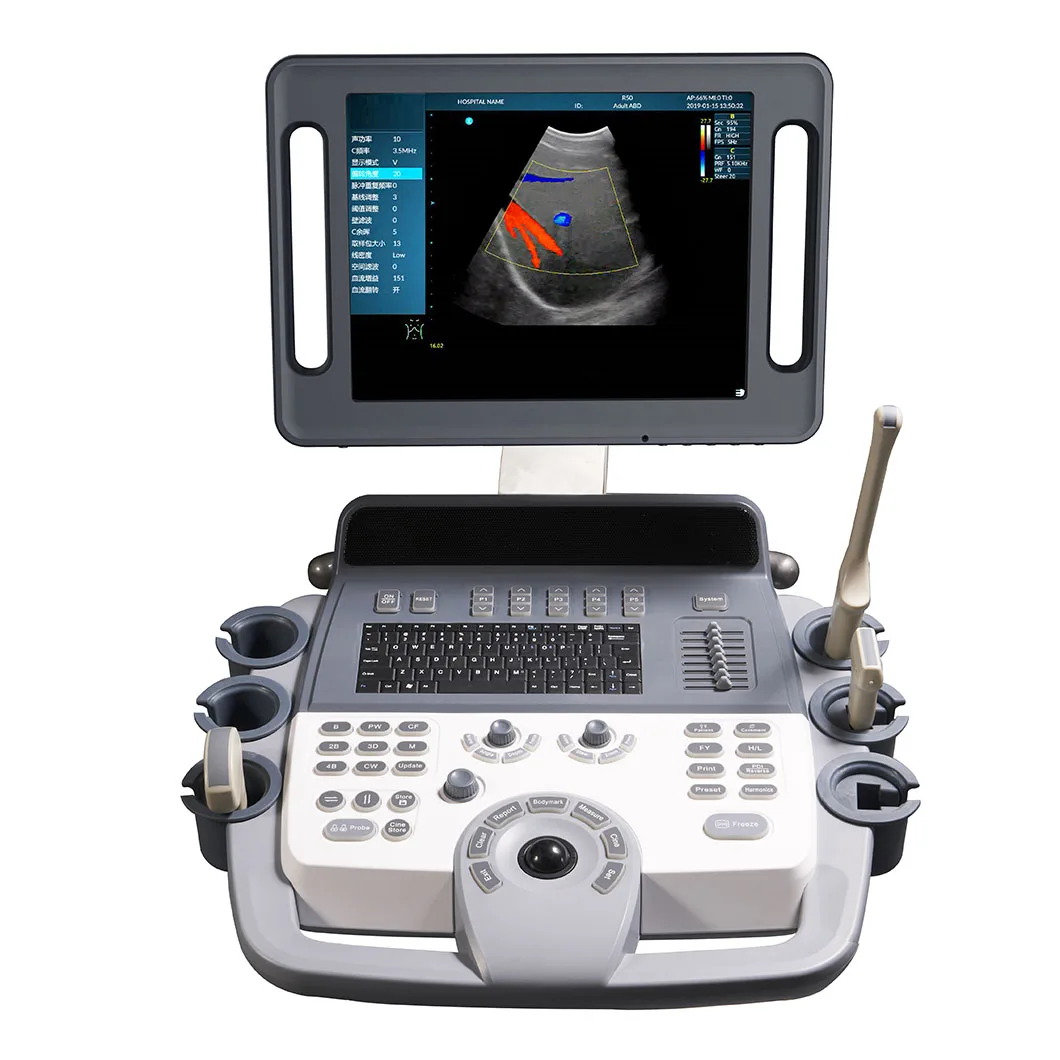 Горячая Распродажа Мобильный аппарат фибросканирования 2D PW THI тележка Цветной Допплер ультразвуковой