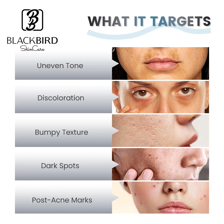 Private Label 5% Azelaic Acid Brightening 50g Facial Cream Natural Organic Whitening Hydrating Anti Aging Beauty Face Cream