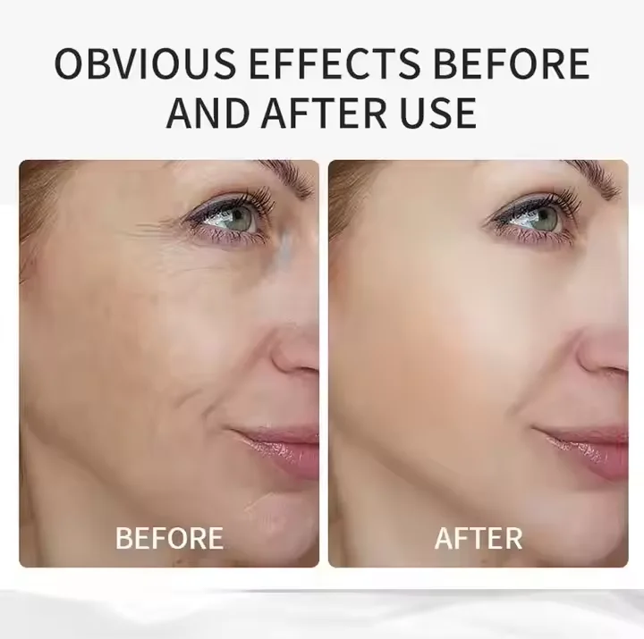 Гиалуроновая кислота 2% оригинальная жидкая гладкая мышечная основа отшелушивающая и Увлажняющая Жидкость для ухода за лицом