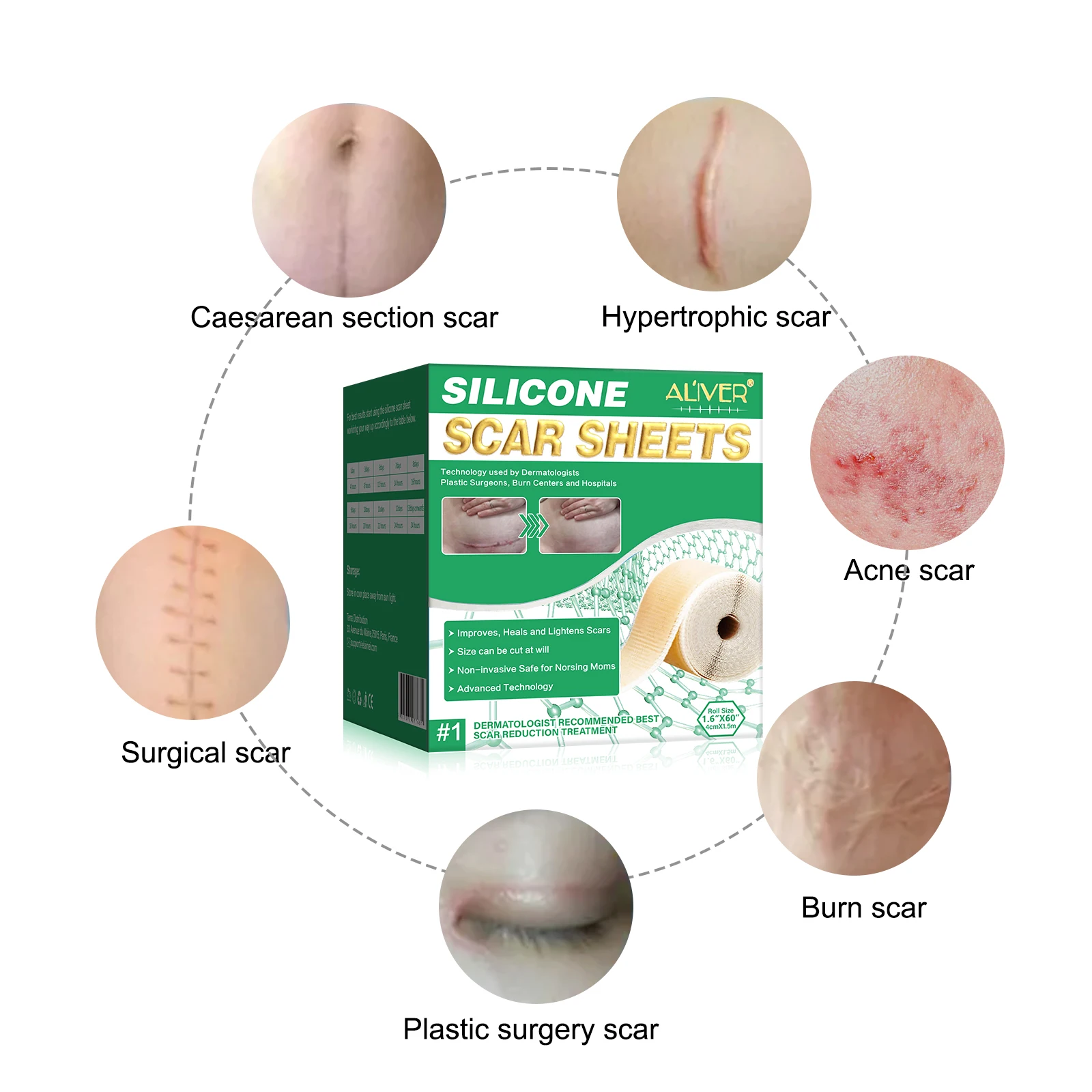 ALIVER Scar Cover Sheets Tape Advanced Silicone Scar Sheet for Face Body Breast Legs Arms Scar Repair