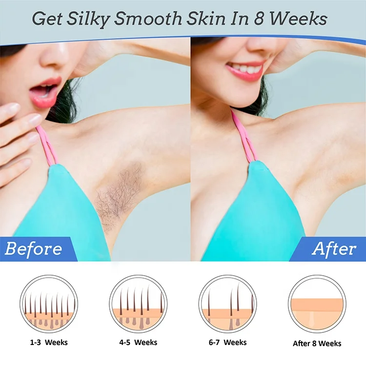 
trending products 2021 new arrivals laser hair removal machine at home 