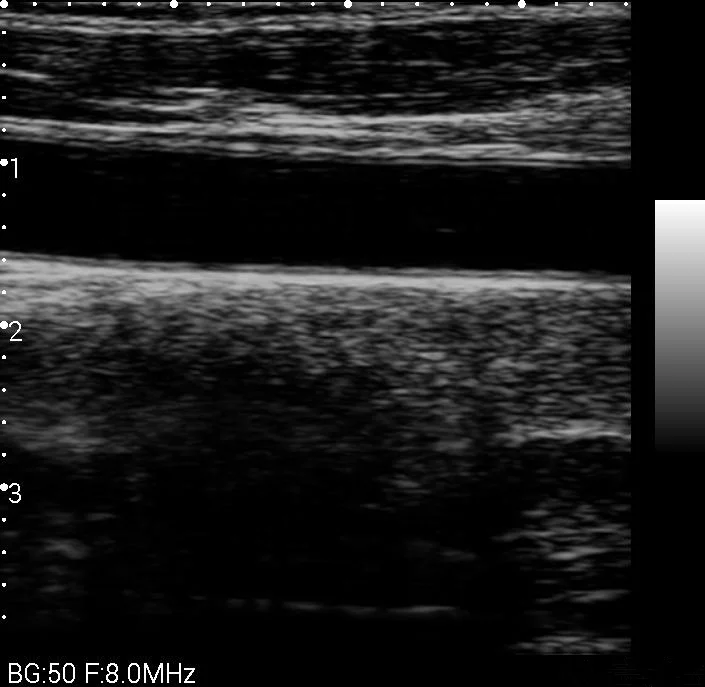 
1280*720 High Resolution Pocket Color Ultrasound Device Mini Handheld WIFI Ultrasound USB Probe 