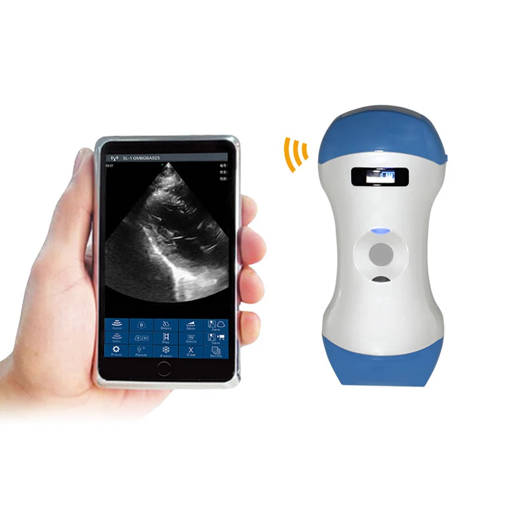Suresult  Medical Ready to Ship Portable Animals Ultrasound/ Veterinary Ultrasound Machine/vet Handheld Ultrasound Scanner
