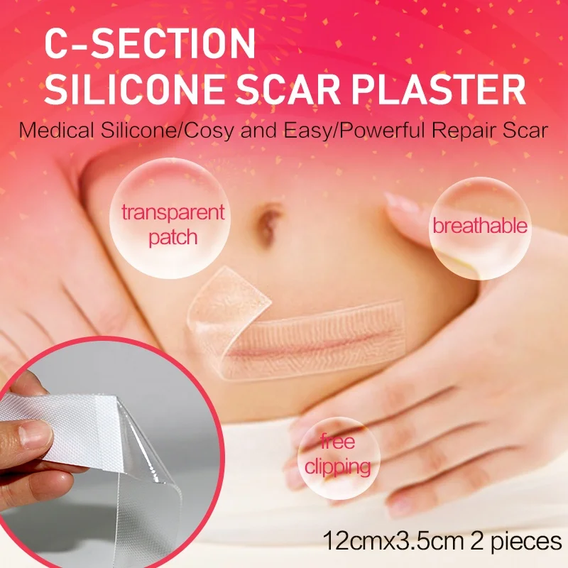 Высококачественная клейкая силиконовая лента для удаления шрамов cesarean, силиконовый Гель для удаления шрамов, силиконовый Гель для шрамов, медицинская одежда