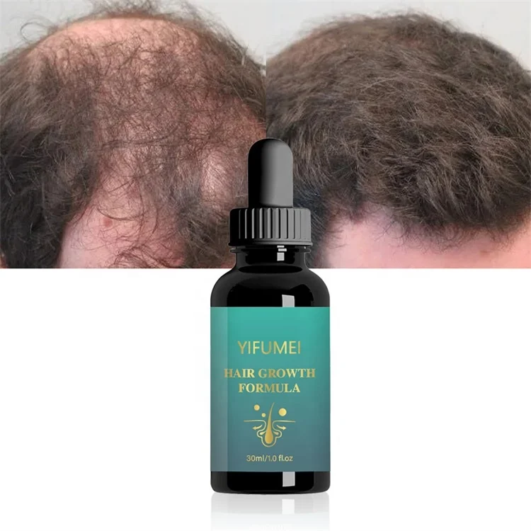4 In 1 Ginger Ginseng Polygonum Grapeseed Oil Damaged Hair Repair Alopecia Hair Loss Regrowth Growth Treatment Oil