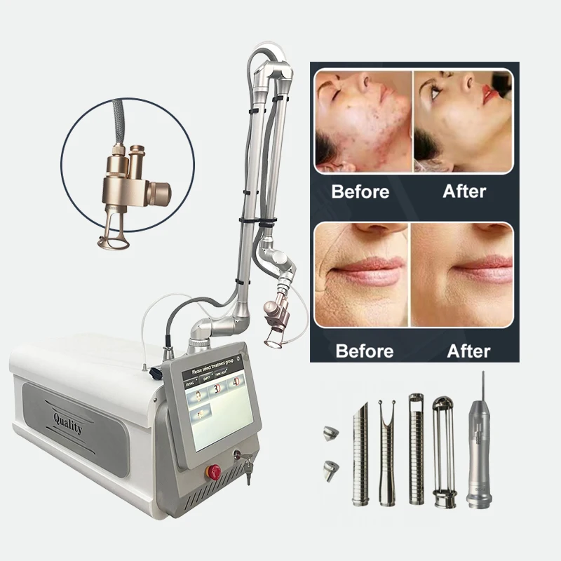 Fractional Co2 Laser 3500W Diode  Co2 Fractional Laser Machine With Fume Extractor  Fractional Medical  3 In 1 Co2 Lase Cor
