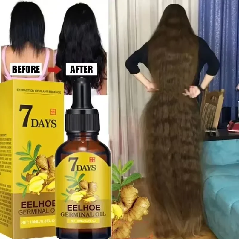 7 Day Fast Hair Growth Oil Ginger Growth Hair Treatment Anti Hair Loss Men Women Scalp Treatment Serum Products Beauty Product