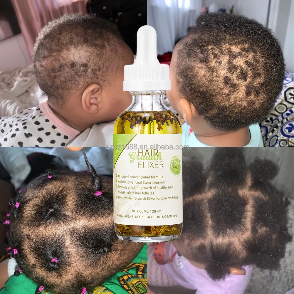OEM 100% Natural Sultfate Free Hair and Scalp Deep Treatment Baby Hair Growth Oil For Kids Regrowth