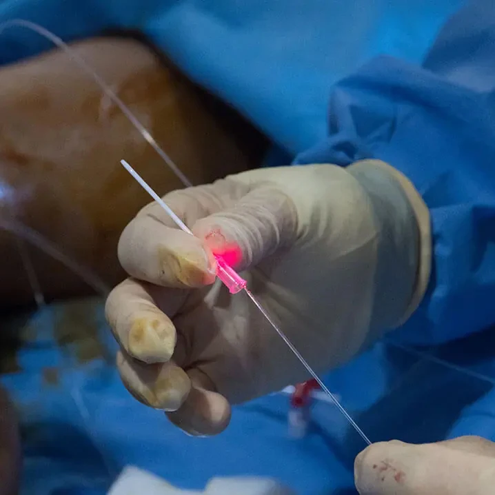 Hot Sale Model 980nm1470nm Double Wave Diode Laser For The Treatment Of Varicose Vein Vascular Disease