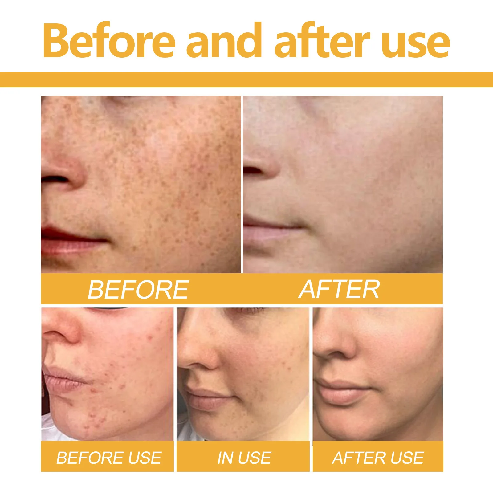 EELHOE Wholesale Gentle Cleansing, Facial Fade Spot Brightening Skin Brightening Moisturizing Curcuma Acid Soap