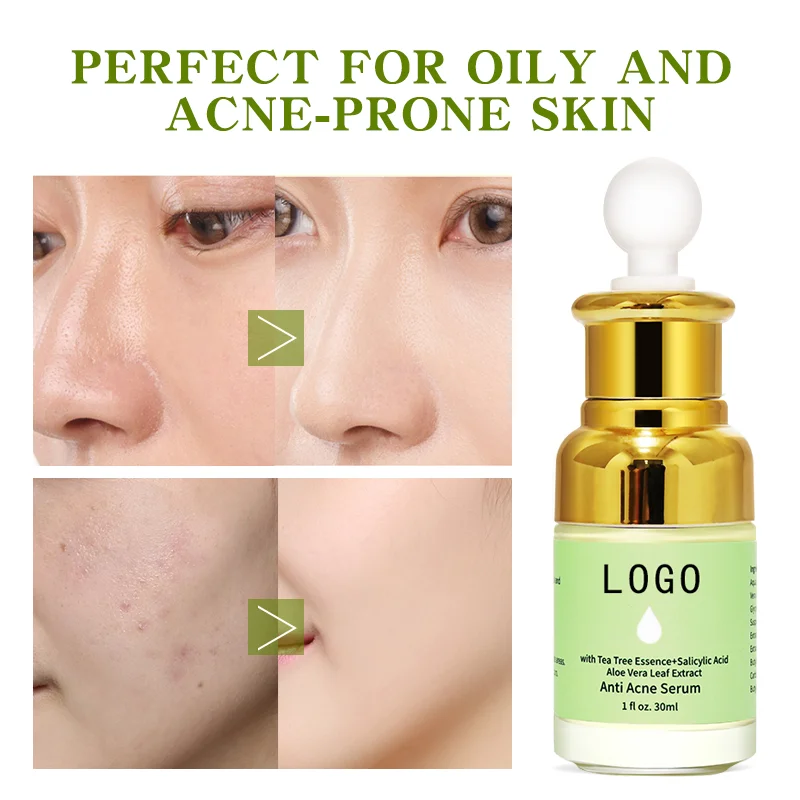 Jiajie Wholesale Enhancement Muscle Soothing Nourishing Micro Needle Repair serum microneedling serum